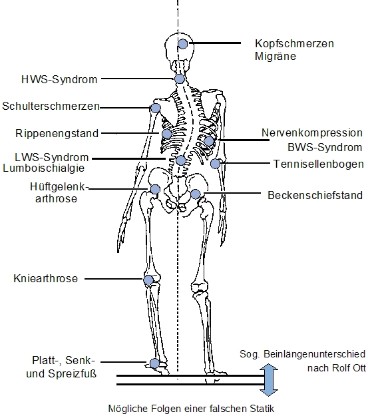 Wirbelsäulenbasisausgleich 